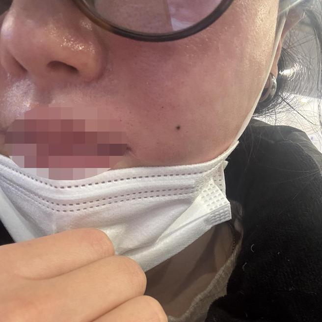 피부 건조함 때문에 리즈네로 선택했는데 만족합니다ㅎㅎ