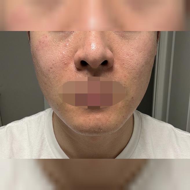 와이프 추천으로 포텐자 받았는데 효과 기대됩니다!