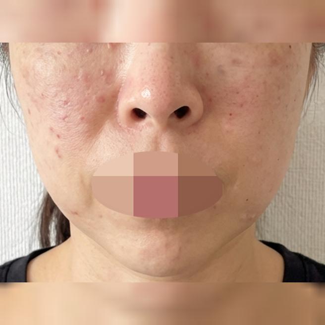 수면으로 리쥬란 가능한 곳 찾다가 방문했어요~