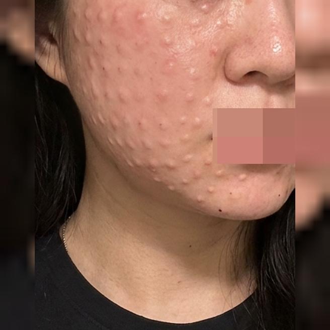 피부 탄력 고민에 받은 리쥬베룩, 일본어 응대까지 완벽했어요~!!