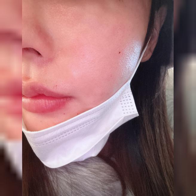 다들 친절하시고, 꿀피부 될 때까지 달려볼게요~