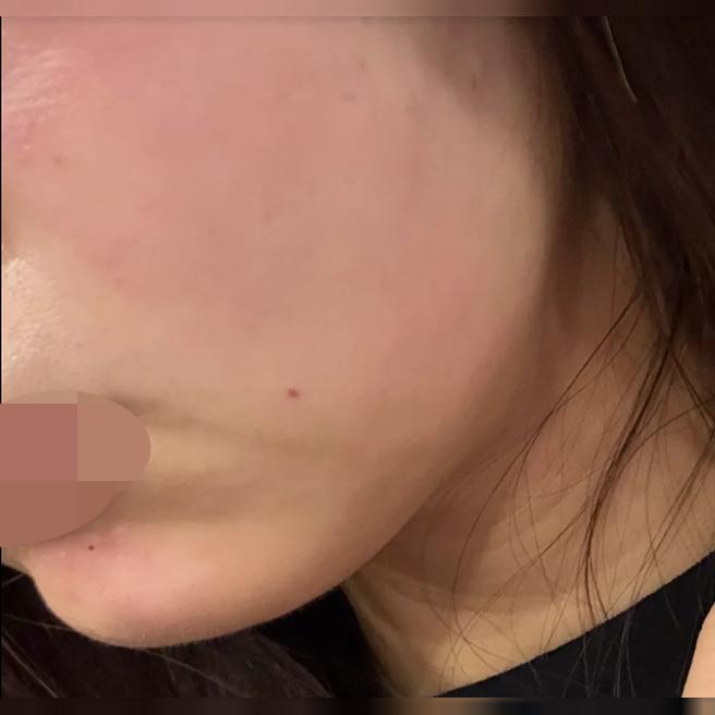친절한 응대에 통증 없는 시술까지, 다시 한국 올 때 꼭 방문할 곳이에요~!