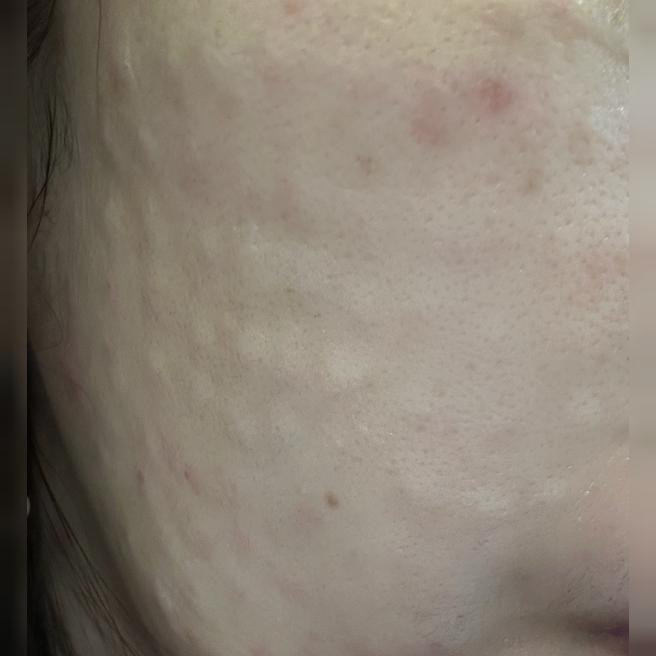 일본어 응대까지 가능한 곳, 리쥬란 또 받으러 왔어요ㅎ