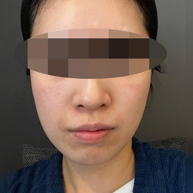 쥬베룩아이 3회 끊었는데 1회차부터 대박인 것 같아요ㅎㅎ