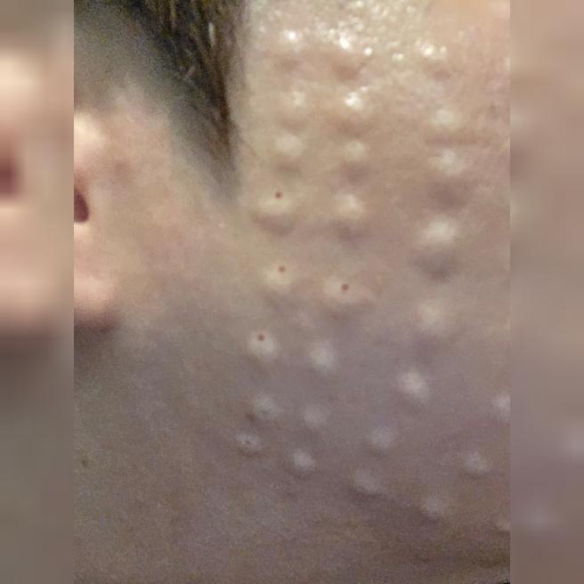 과한 업셀링 없이 부담 없이 시작한 시술, 주기적으로 받고 있습니다!