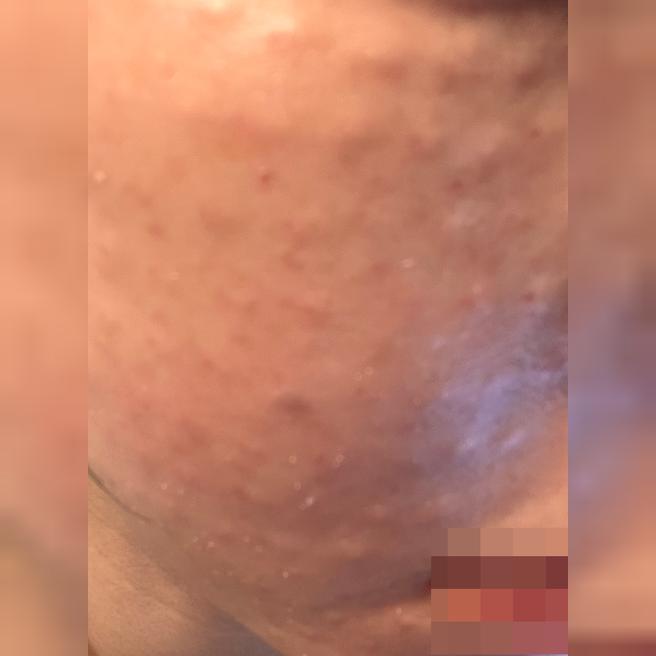리즈네는 여기서만! 효과부터 응대까지 다 만족이에요~~