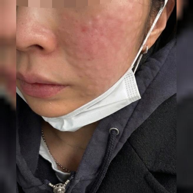 쾌적한 분위기에서 수면 리쥬란 편하게 받았어요~