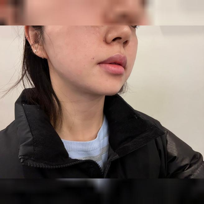속건조 심해서 받아봤는데 대만족이에요~~