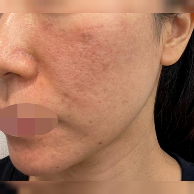 매끄러운 동선에 친절한 응대까지! 만족스럽게 받고 왔어요~ㅎㅎ