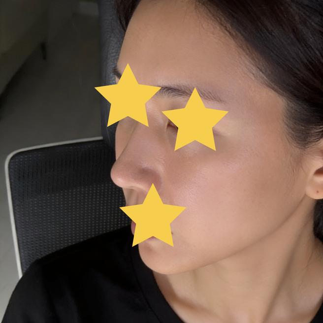 쥬베룩 3일차 후기 ! 홍조 빠지면서 슬슬 기대되기 시작했어요