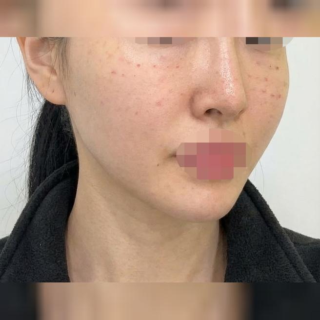 나비존 모공 때문에 받았는데, 받길 잘한 것 같네요~ㅎㅎ
