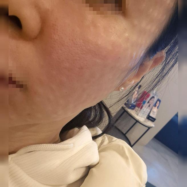 추가 권유 없고, 수면으로 받아서 편하게 받았습니다!
