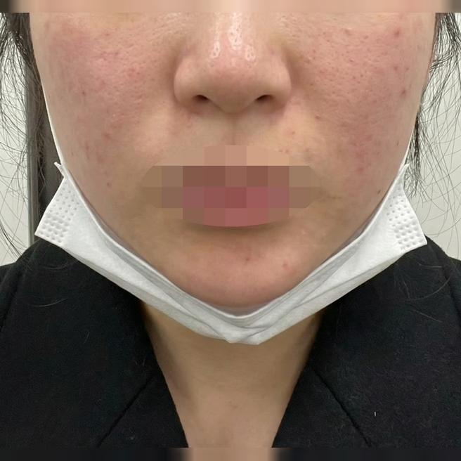 리쥬란 받았는데 효과 보이면 꾸준히 다니려고요~