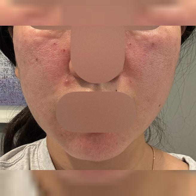 빠른 응대에 꼼꼼한 케어까지, 모공 관리는 여기서 받을라고요~ㅎㅎ