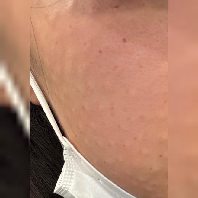 피부 건조해서 받았는데 다들 친절해서 만족이에요 ㅎㅎ