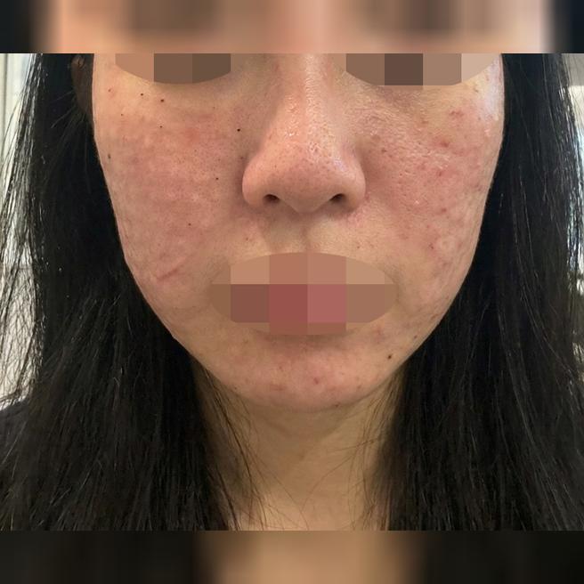 절한 응대에 솔직한 상담까지, 꾸준히 다닐 예정이에요~