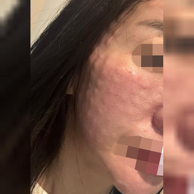 엠보 빵빵하게 잘 잡혀서 대만족이라 재방문 할려고요ㅎㅎ