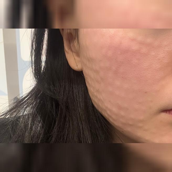후기 보고 왔는데 원장님 먼저 상담해주셔서 좋았어요 ㅎㅎ