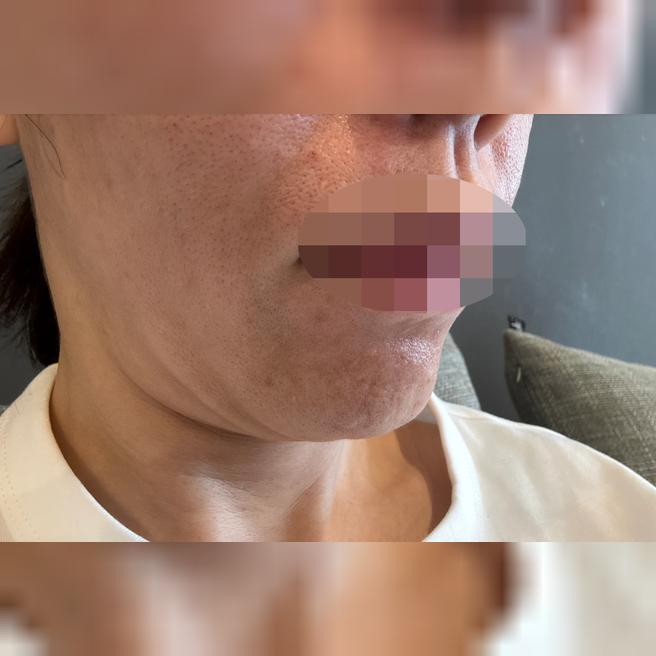 한국 방문 김에 받아봤는데 통역 덕분에 불편함 없이 끝났어요!