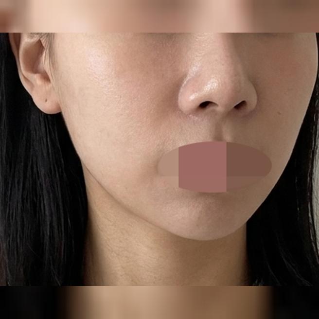 모공 고민으로 포텐자, 업셀링 없이 고민만 들어주셔서 좋았어요!