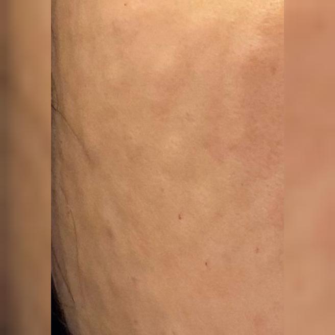 모공이랑 피부결이 고민이라 받은 리쥬베룩 7일차 됐어요! 