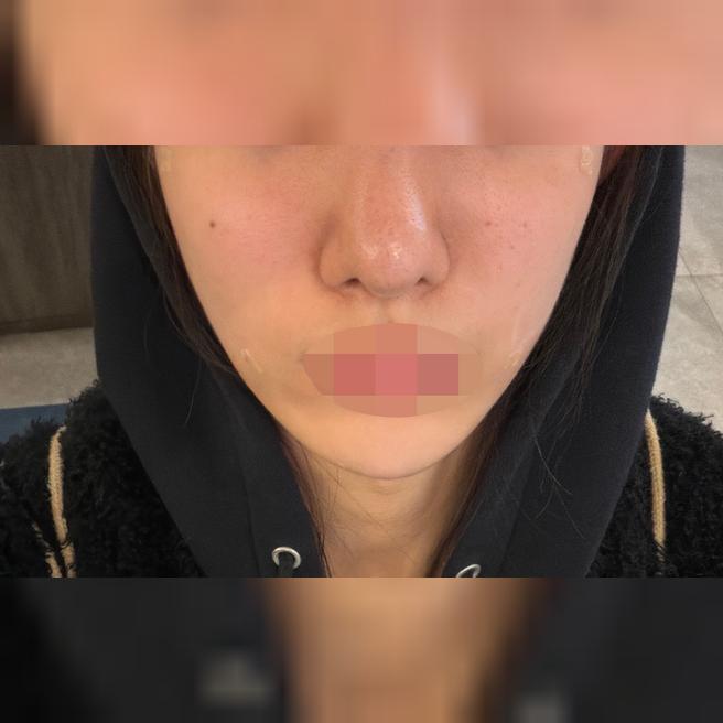 스컬트라 받았는데 다들 친절하고 완전 만족이에요 ㅎㅎ