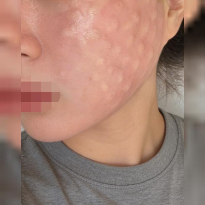 탄력이랑 생기 떨어진 것 같아서 스킨바이브 받으러 방문했어요