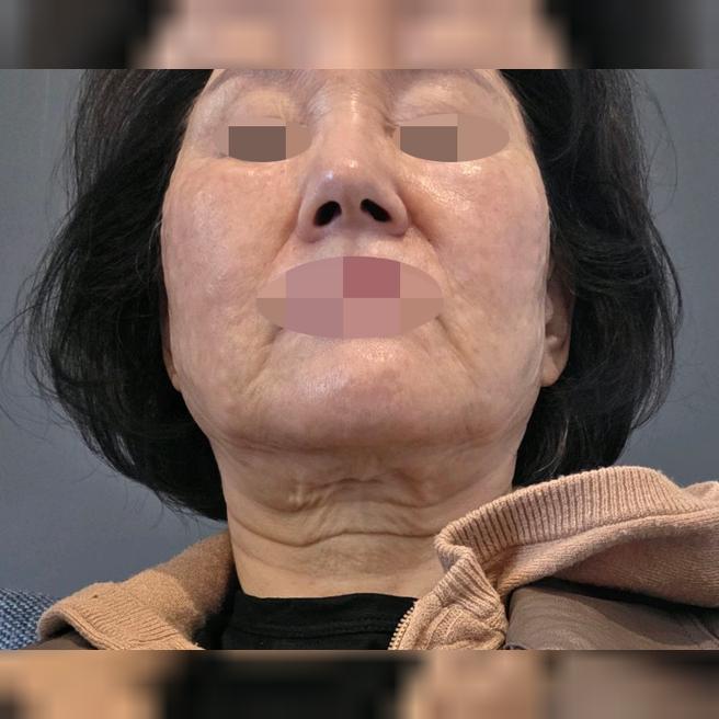 리쥬란 늘 믿고 다니는데 꼼꼼하셔서 항상 방문합니다~