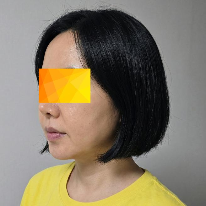 브아셀 3주차, 슬슬 콜라겐이 차오르는 느낌이에요 