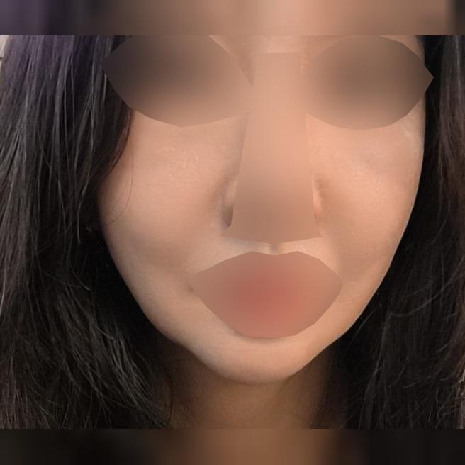 2회차인데 꼼꼼해서 한 달 후 3회차도 받으러 올 거예요 ㅎㅎ
