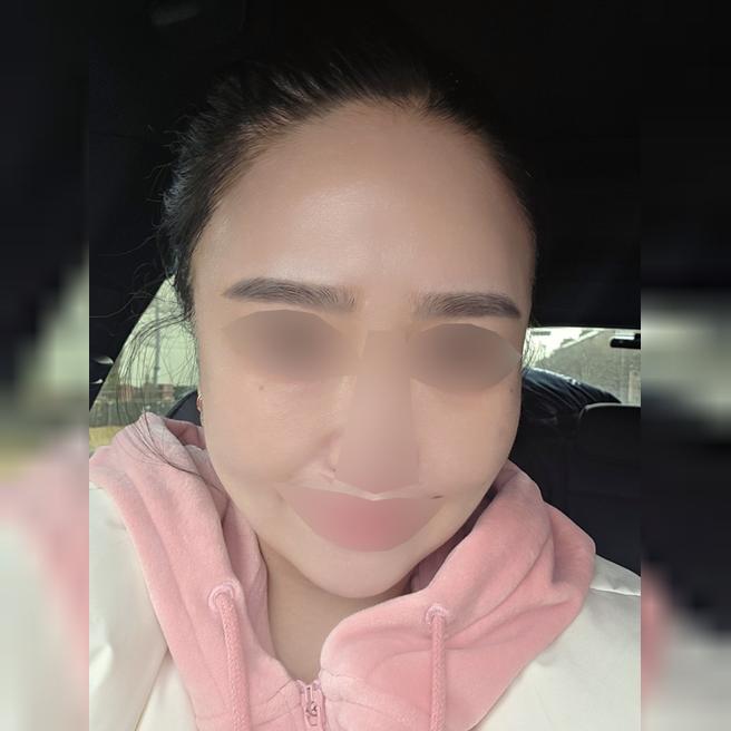 수면으로 편하게 받은 쥬베룩, 효과 보고 3회 채울 예정이에요~