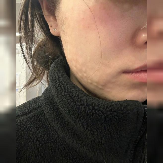 대기시간 있어도 올 만한 곳! 리쥬란 받고 왔어요