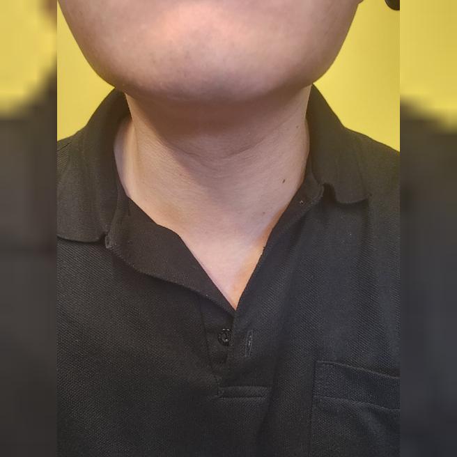 턱살이랑 이중턱 잡으려고 인모드 받아봤습니다.