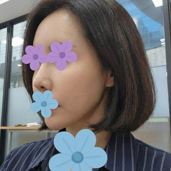 리즈네 3주차 후기 – 거울 볼 때마다 기분 좋아지는 피부 됐어요