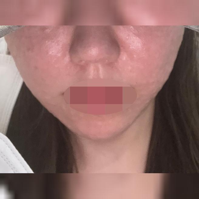 리쥬베룩 받았는데 엠보 촘촘해서 감동이에요 ㅎㅎ