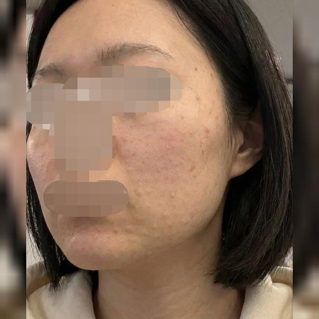 엠보 잘 남고 시설도 좋아서 여러모로 대만족이에요!!