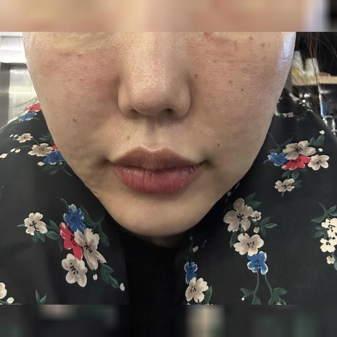 최웅규원장님 진짜 꼼꼼하시고 실장님들도 너무 친절해서 맨날 여기와요ㅎㅎ