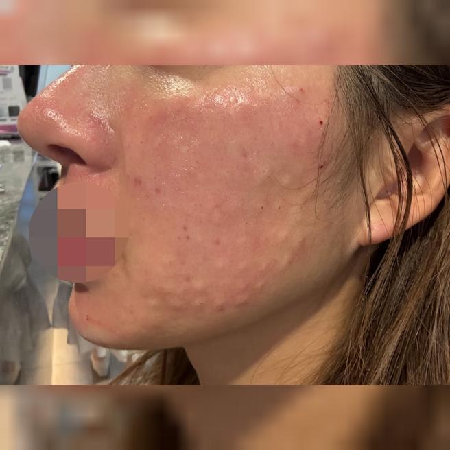 좋은 가격에 좋은 시술까지, 외국인 손님들이 많이 찾는 이유가 있어요!!