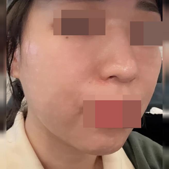 수면마취 덕분에 통증 없이! 한 달에 한 번 꼬박꼬박 올게요