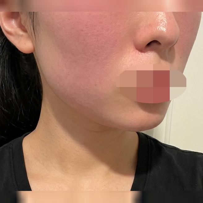 역과 가깝고 대기 짧은 곳, 남은 2회차도 여기서 받을 예정이에요