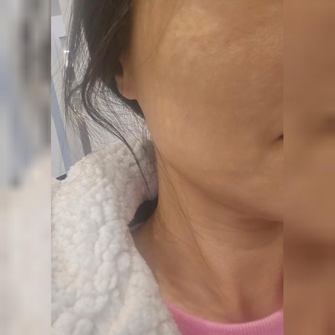 첫 방문 긴장 싹 녹았어요~ 서울아이 친절함 소문 그대로네요!