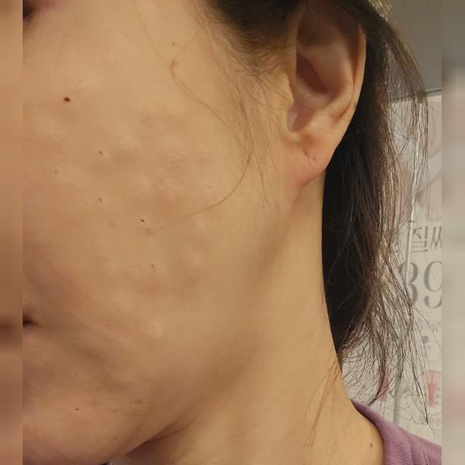 리쥬란 수면으로 받았는데 정품 확인해주시고 엠보 촘촘해서 만족이에요 ㅎㅎ