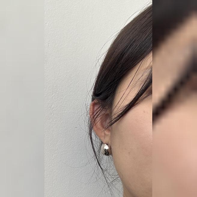 통증도 없이 편하게 시술 받아서 너무 만족스러워요~!!