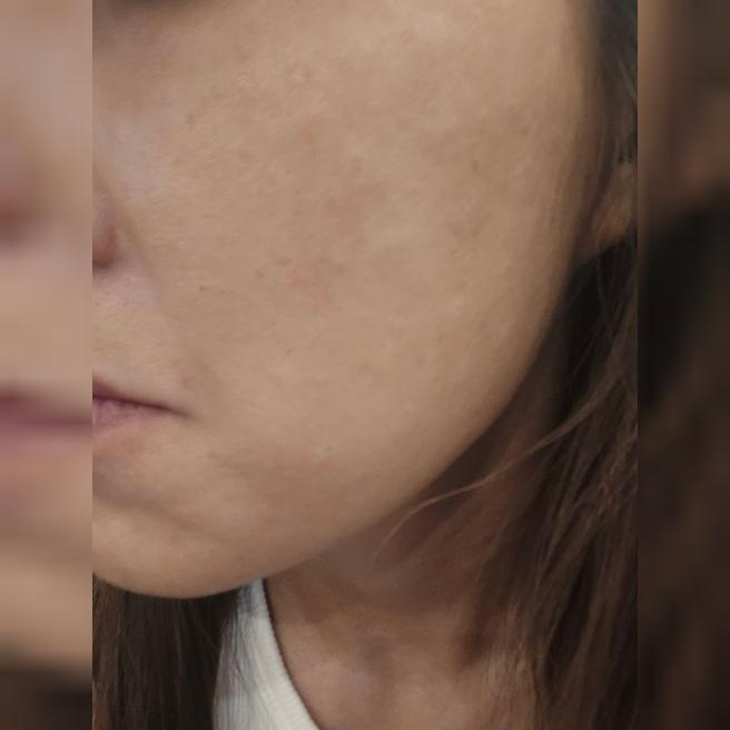 수면으로 쥬베룩 빠르게 받았는데 엠보도 금방 가라앉아서 좋았어요~