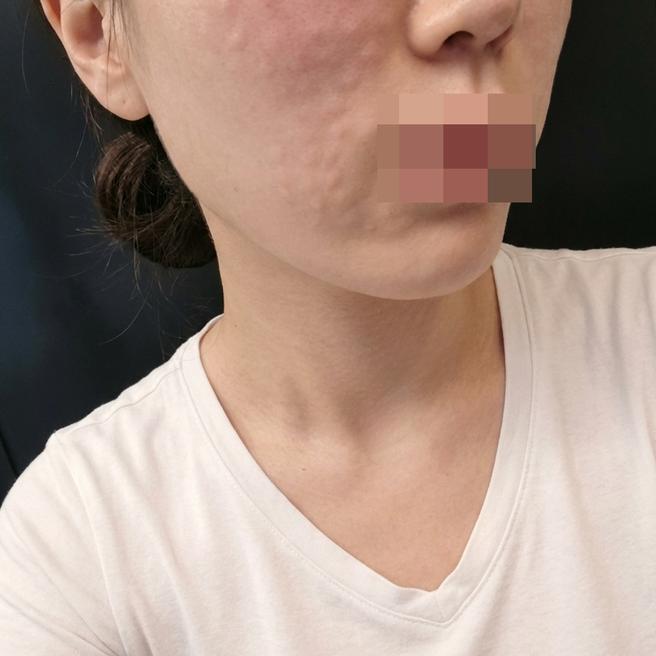 친절한 응대에 만족스러운 시술까지! 다음 달에도 또 갈게요ㅎㅎ