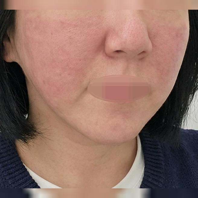 군더더기 없는 상담에 만족스러운 결과까지, 리즈네 강추예요~