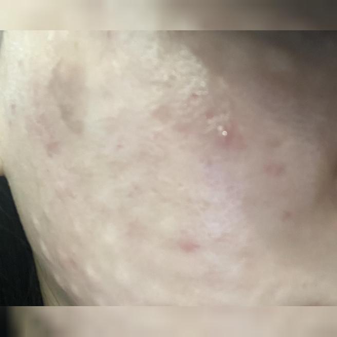 팩으로도 도저히 안 되던 푸석한 피부, 드디어 제대로 된 답을 찾은 것 같아요ㅎㅎ