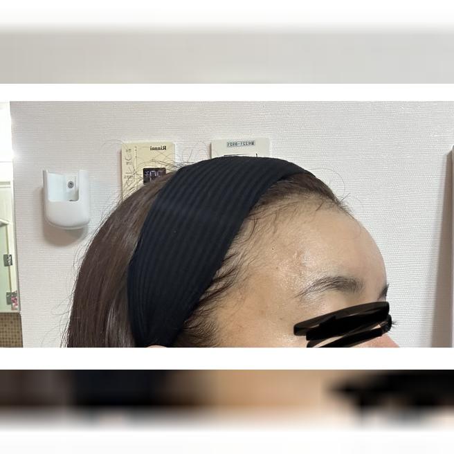 잔주름 화장 들뜸 때문에 왔는데 꼼꼼하게 해주셔서 2차 예약했어요ㅎ