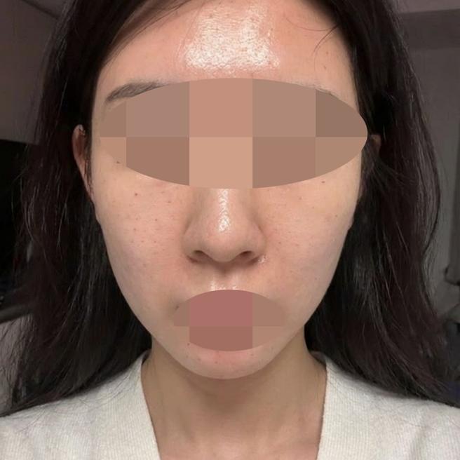 리쥬란 여기서 받았는데 엠보 확실해서 좋은 것 같아요!