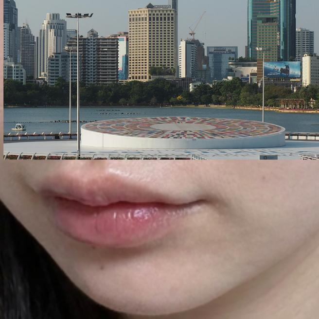 입술필러 2주차..티 안 나게 자연스러운 게 이런거구나
